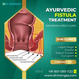 Anal Fistula Treatment in Manesar Call 8010931122