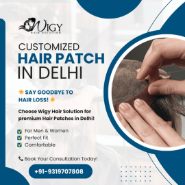 Customized Hair Patch in Delhi – Wigy Hair Solutio