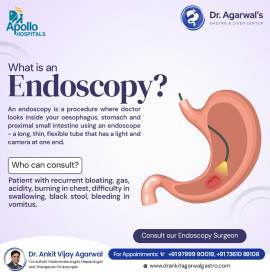 stomach ulcer treatment In Hyderabad-Dr.Ankit