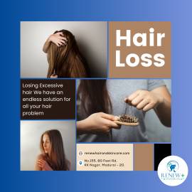 Hair Fall Treatment in Madurai  - Renew Hair and S