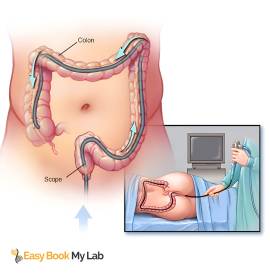 Colonoscopy test center in Delhi | Easy book my la