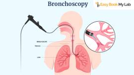 Bronchoscopy Test Centre In Delhi NCR | Easy Book 