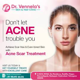 Best Skin Specialist in Peerzadiguda | Hair Loss T