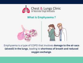 Exceptional Lungs Specialist Doctor Near Me