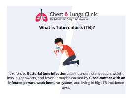 Find Relief with the Best Asthma Doctor Near Me