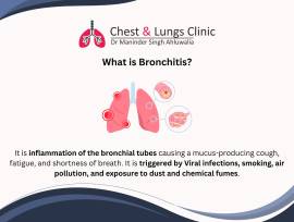 Leading Pulmonologist in Chandigarh