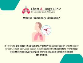 Leading Pulmonologist in Chandigarh