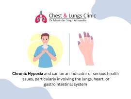Trusted Chest Specialist in Chandigarh