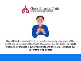Trusted Chest Specialist in Chandigarh