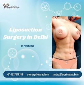 The Best Liposuction Surgery Surgery in Delhi 