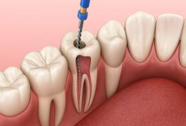 Dental Hospital | Best Dental Hospital In Madurai