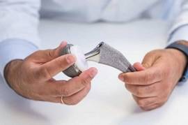 Top 8 Things to Consider When Choosing an Orthoped