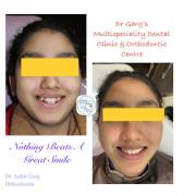 Best dental Clinic in Meerut 