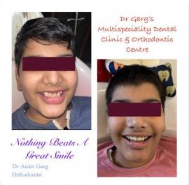 Best dental Clinic in Meerut 