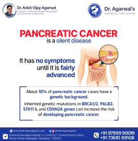 Pancreatitis treatment in Hyderabad