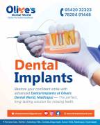   How Dental Implants Restore Your Smile?